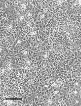 Murine Leukemia Virus (MLV)-based Coronavirus Spike-pseudotyped  Particle Production and Infection