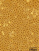 Mouse Model of Dengue Virus Infection with Serotypes 1 and 2 Clinical Isolates