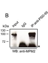 MPM-2 Mediated Immunoprecipitation of Proteins Undergoing Proline-directed Phosphorylation