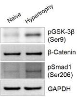 In vitro Chondrogenic Hypertrophy Induction of Mesenchymal Stem Cells