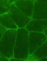 Measurement of Mechanical Tension at cell-cell junctions using two-photon laser ablation