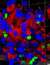  Generation of Tumour-stroma Minispheroids for Drug Efficacy Testing