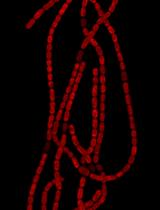 Fluorescence in situ Localization of Gene Expression Using a lacZ Reporter  in the Heterocyst-forming Cyanobacterium Anabaena variabilis