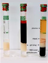 使用Vacutainer®细胞制备管（CPTTM）分离外周血单核细胞