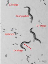 P-body and Stress Granule Quantification in Caenorhabditis elegans