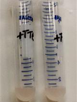 Quantification of Triphenyl-2H-tetrazoliumchloride Reduction Activity in Bacterial Cells