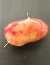 小鼠泌尿系统中CFT073致病性大肠杆菌的毒力分析