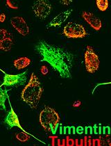 Analysis of Cancer Stromal Reaction Using an O-ring Co-culture Assay