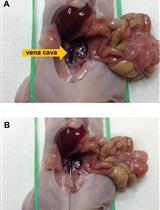 Protocol for Murine/Mouse Platelets Isolation and Their Reintroduction <em>in vivo</em>