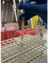Adhesion Assay for Murine Bone Marrow Hematopoietic Stem Cells