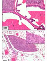 A Murine Orthotopic Allograft to Model Prostate Cancer Growth and Metastasis
