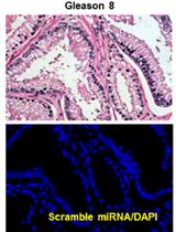 In situ Hybridization (ISH) and Quantum Dots (QD) of miRNAs