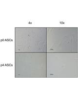 Isolation and Primary Culture of Adult Human Adipose-derived Stromal/Stem Cells