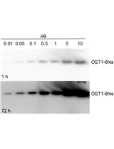In Gel Kinase Assay
