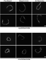 Protein Synthesis Rate Assessment by Fluorescence Recovery after Photobleaching (FRAP)