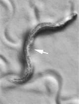Measuring Caenorhabditis elegans Sleep during the Transition to Adulthood Using a Microfluidics-based System