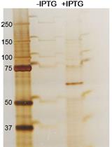 Measurement of RNA-induced PKR Activation in vitro