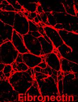 3D Stroma Invasion Assay