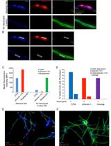 In vitro Detection of Neutrophil Traps and Post-attack Cell Wall Changes in Candida Hyphae