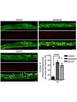 In vivo Mitophagy Monitoring in Caenorhabditis elegans to Determine Mitochondrial Homeostasis