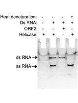 RNA Strand Displacement Assay for Hepatitis E Virus Helicase