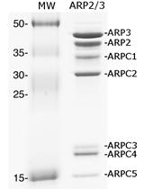 重组细菌效应子存在条件下ARP2/3磷酸化修饰的检测