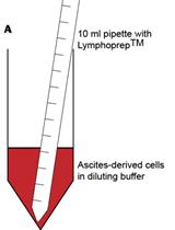 Isolation of Mononuclear Cell Populations from Ovarian Carcinoma Ascites