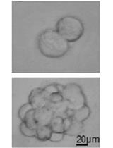 Melanoma Stem Cell Sphere Formation Assay