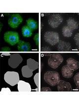 Single Molecule RNA FISH in Arabidopsis Root Cells