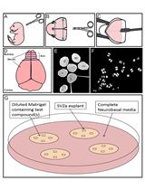 采用外植体方法分析神经母细胞迁移