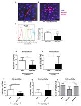 Analysis of Mitochondrial Transfer in Direct Co-cultures of Human Monocyte-derived Macrophages (MDM) and Mesenchymal Stem Cells (MSC)