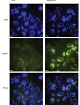 Immunostaining of Formaldehyde-fixed Metaphase Chromosome from Untreated and Aphidicolin-treated DT40 Cells