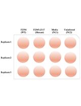 Adhesion and Invasion Assay Procedure Using Caco-2 Cells for Listeria monocytogenes