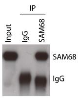 Analysis of <em>in vivo</em> Interaction between RNA Binding Proteins and Their RNA Targets by UV Cross-linking and Immunoprecipitation (CLIP) Method