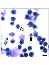 小鼠支气管肺泡灌洗