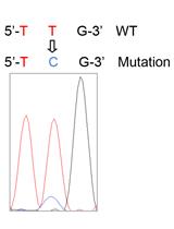 Isolation of Murine Alveolar Type II Epithelial Cells