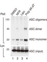 Detection of ASC Oligomerization by Western Blotting