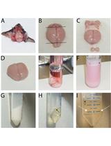 Isolation and Cultivation of Primary Brain Endothelial Cells from Adult Mice