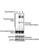 Phos-tag免疫印迹分析检测IRF5磷酸化