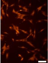 Primary Olfactory Ensheathing Cell Culture from Human Olfactory Mucosa Specimen