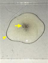 Isolation and Infection of <em>Drosophila</em> Primary Hemocytes