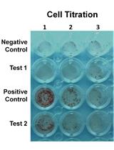 ELISPOT Assay to Measure Peptide-specific IFN-γ Production