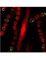 Protein Localization in the Cyanobacterium Anabaena sp. PCC7120 Using Immunofluorescence Labeling