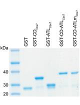 Producing GST-Cbx7 Fusion Proteins from <em>Escherichia coli</em>