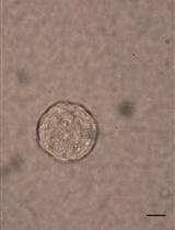 Soft Agar Colony Formation Assay as a Hallmark of Carcinogenesis