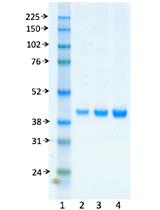 In vitro Assay to Measure DNA Polymerase β Nucleotide Insertion Coupled with the DNA Ligation Reaction during Base Excision Repair