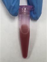 Qualitative and Quantitative Assay for Detection of Circulating Autoantibodies against Human Aortic Antigen