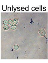 Active Cdk5 Immunoprecipitation and Kinase Assay