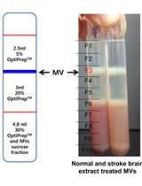 Microvesicle Isolation from Rat Brain Extract Treated Human Mesenchymal Stem Cells