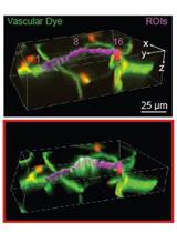 Photothrombotic Induction of Capillary Ischemia in the  Mouse Cortex during in vivo Two-Photon Imaging